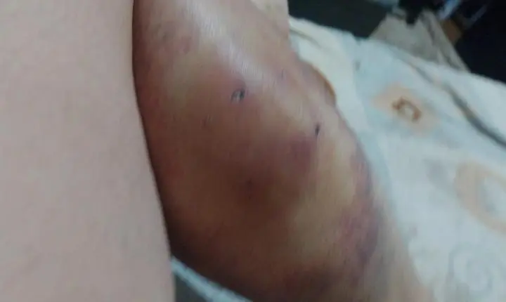Moradora fica ferida após ser mordida por cachorro solto no Jardim Marumbi, em Mandaguari